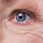 Effective Retinal Detachment Treatments to Preserve Your Vision